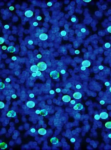 comment-votre-microbiote-influence-votre-poids